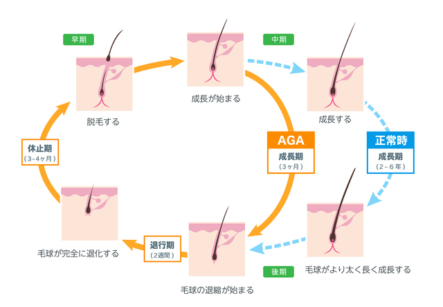 発毛サイクルとAGAのサイクルの図|薄毛・発毛専門のスーパースカルプ岡崎