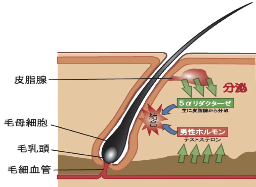 AGAのメカニズム、ホルモンバランス崩壊｜薄毛・発毛専門のスーパースカルプ岡崎