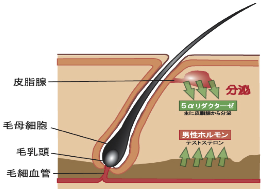 AGAのメカニズム｜薄毛・発毛専門のスーパースカルプ岡崎